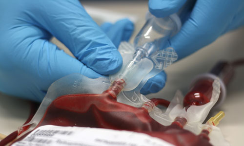 Close up of gloved hands squeezing out a sample of blood of a blood bag.